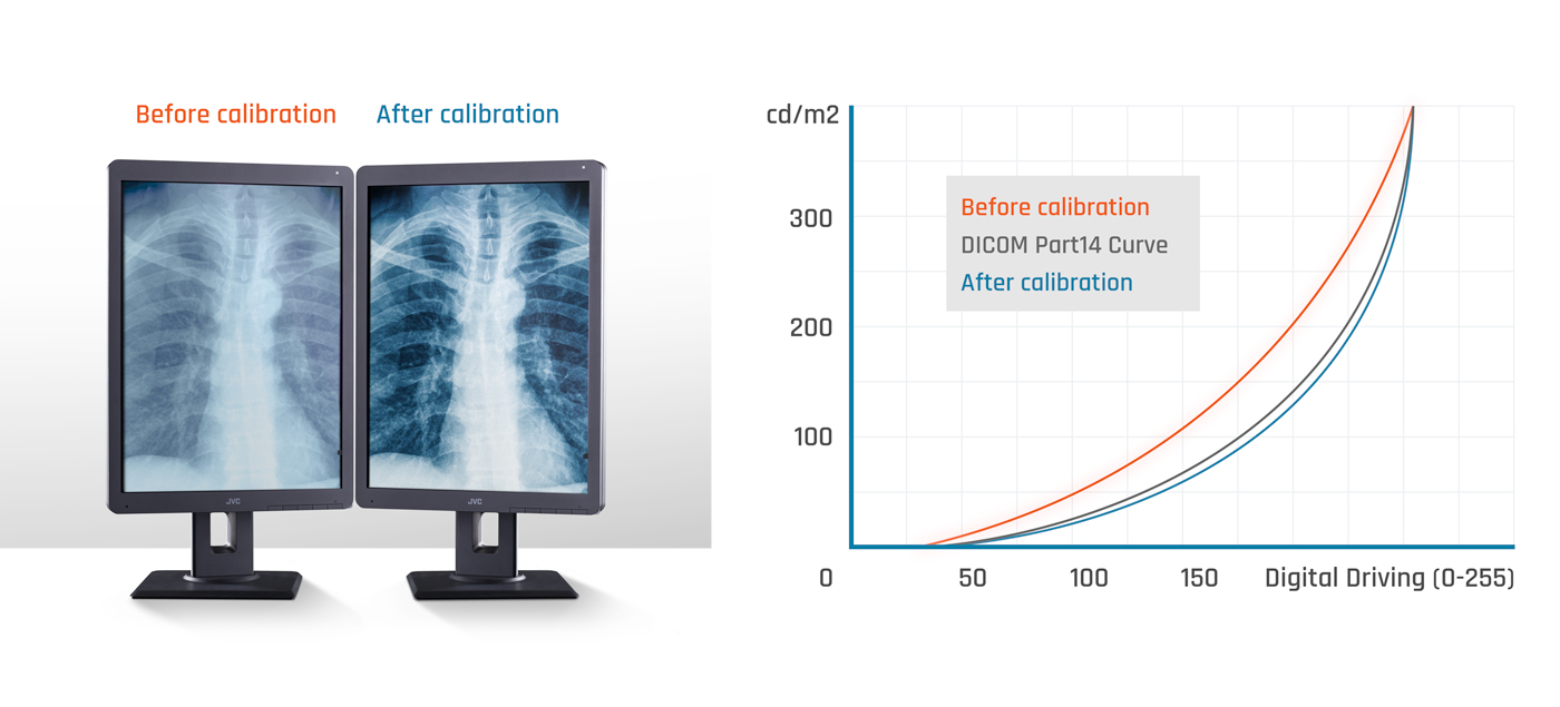 kalibrierte Monitore mit DICOM Preset im Vergleich und einem Kurvendiagram, welches die Unterschiede verschiedener Presets zeigt.